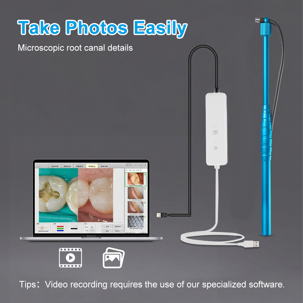 5MP Micro Intraoral Camera Den - Mini Pc Windows reseña y precio